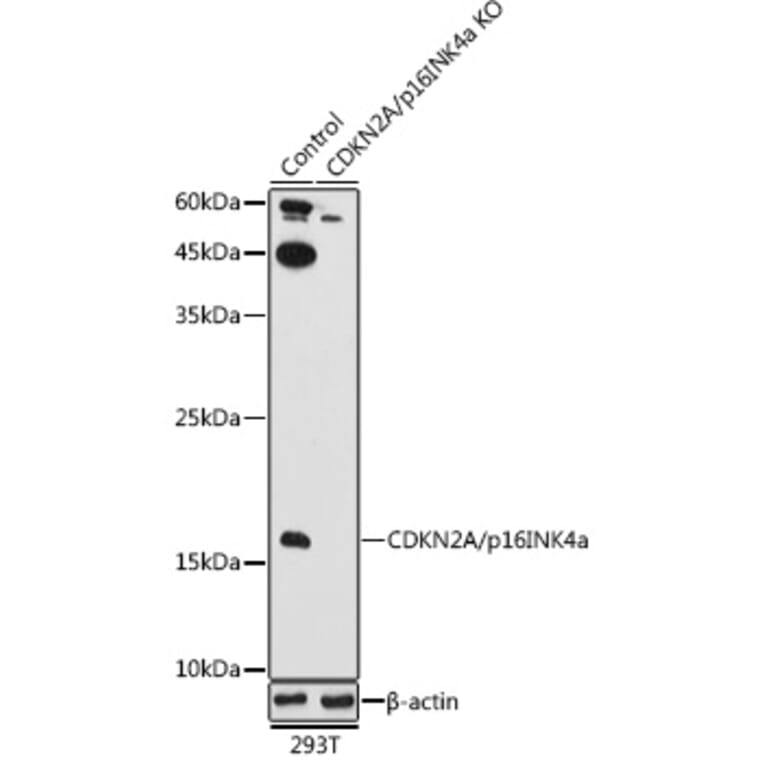 Western Blot - Anti-CDKN2A/p16INK4aF Antibody (A80567) - Antibodies.com