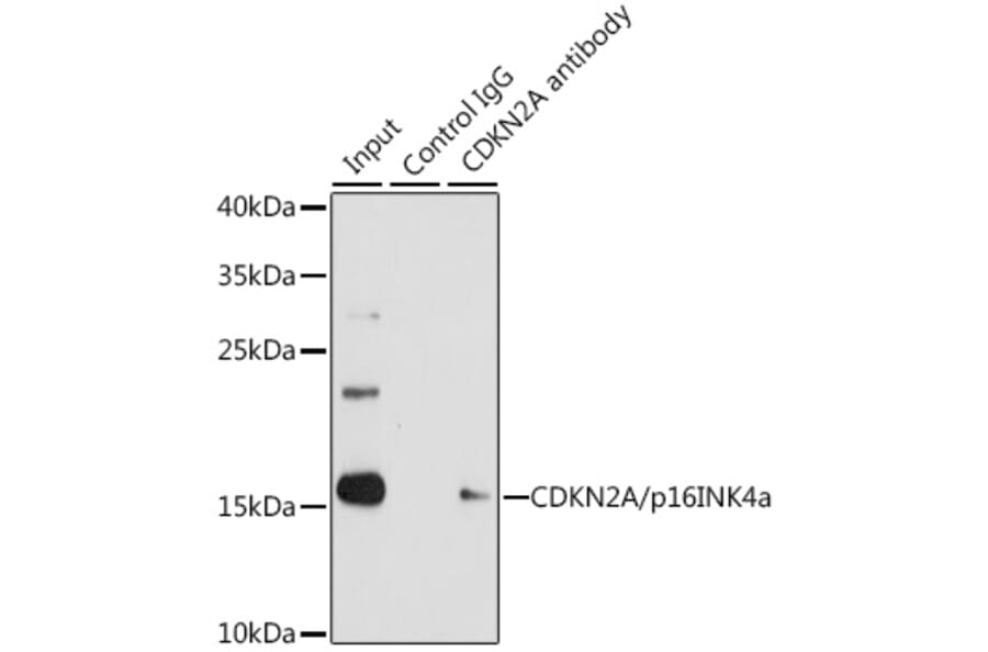 Western Blot - Anti-CDKN2A/p16INK4aF Antibody (A80567) - Antibodies.com