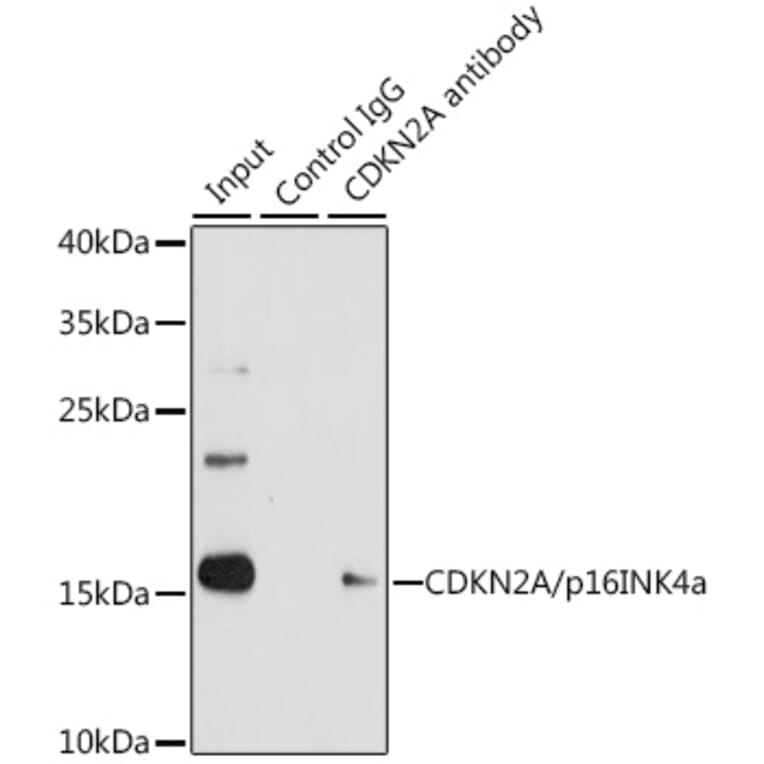 Western Blot - Anti-CDKN2A/p16INK4aF Antibody (A80567) - Antibodies.com