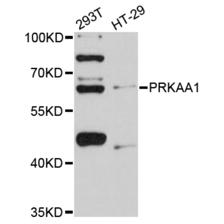 Western Blot - Anti-PRKAA1 Antibody (A11184) - Antibodies.com