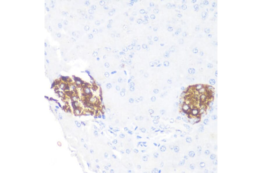 Immunohistochemistry - Anti-PRKAA1 Antibody (A11184) - Antibodies.com