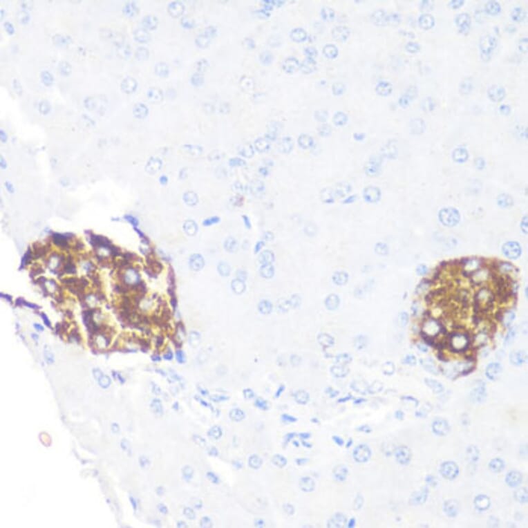 Immunohistochemistry - Anti-PRKAA1 Antibody (A11184) - Antibodies.com