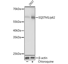 Western Blot - Anti-SQSTM1 / p62 Antibody (A80570) - Antibodies.com