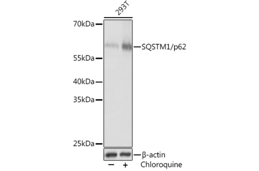 Western Blot - Anti-SQSTM1 / p62 Antibody (A80570) - Antibodies.com