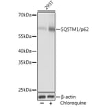 Western Blot - Anti-SQSTM1 / p62 Antibody (A80570) - Antibodies.com