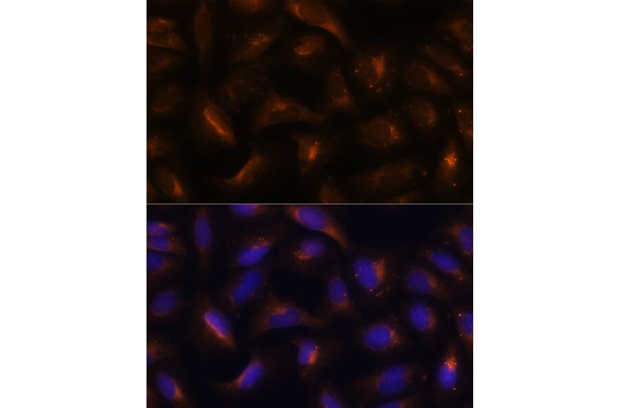 Immunofluorescence - Anti-SQSTM1 / p62 Antibody (A80570) - Antibodies.com