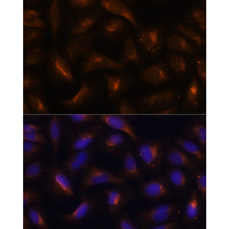 Immunofluorescence - Anti-SQSTM1 / p62 Antibody (A80570) - Antibodies.com