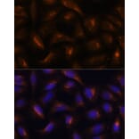 Immunofluorescence - Anti-SQSTM1 / p62 Antibody (A80570) - Antibodies.com