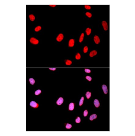 Immunofluorescence - Anti-Cdc25C Antibody (A80571) - Antibodies.com