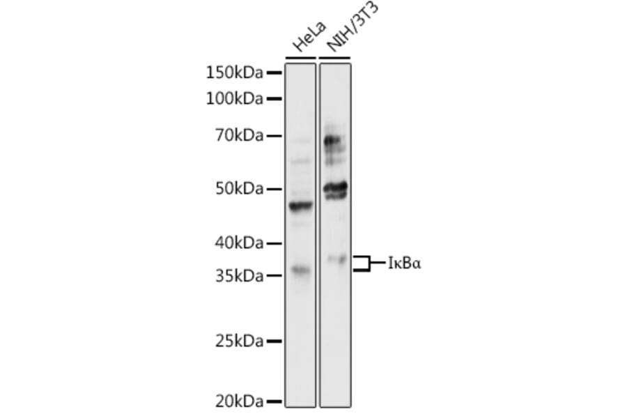 Western Blot - Anti-IKB alpha Antibody (A80572) - Antibodies.com