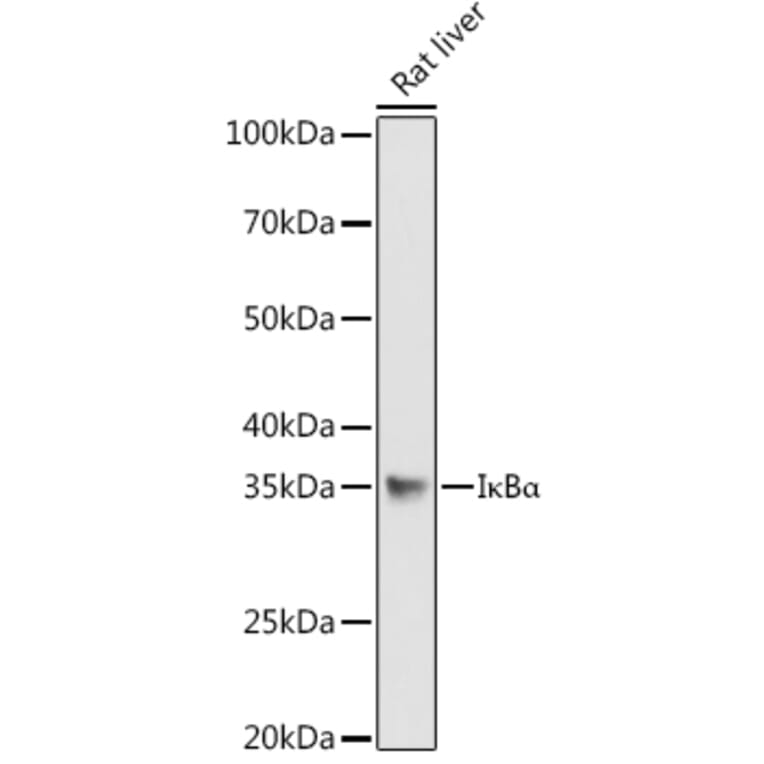 Western Blot - Anti-IKB alpha Antibody (A80572) - Antibodies.com