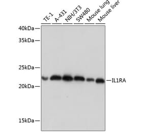Western Blot - Anti-IL-1RA Antibody [ARC0524] (A80574) - Antibodies.com