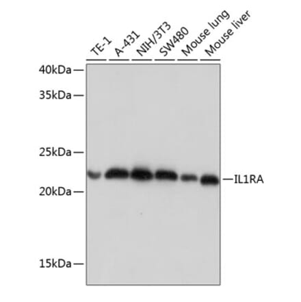 Western Blot - Anti-IL-1RA Antibody [ARC0524] (A80574) - Antibodies.com