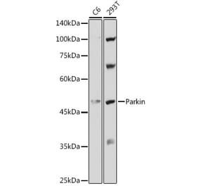 Western Blot - Anti-Parkin Antibody (A80577) - Antibodies.com