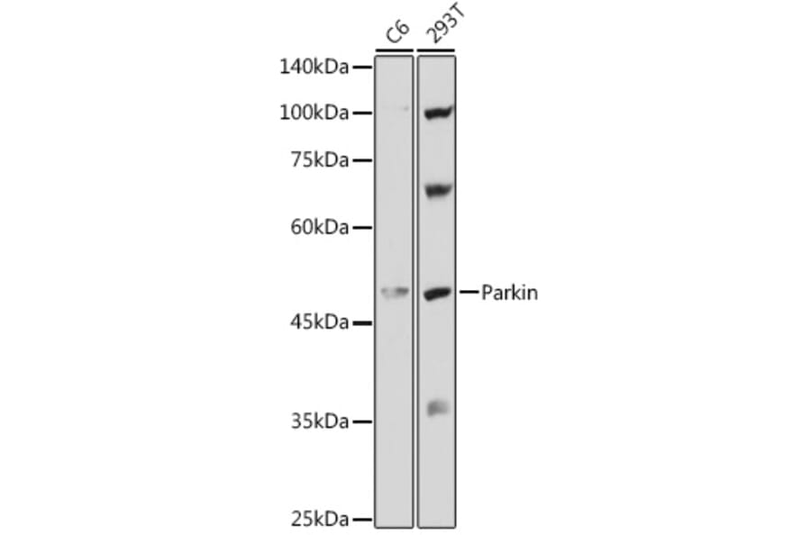 Western Blot - Anti-Parkin Antibody (A80577) - Antibodies.com