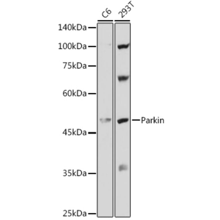 Western Blot - Anti-Parkin Antibody (A80577) - Antibodies.com