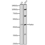 Western Blot - Anti-Parkin Antibody (A80577) - Antibodies.com