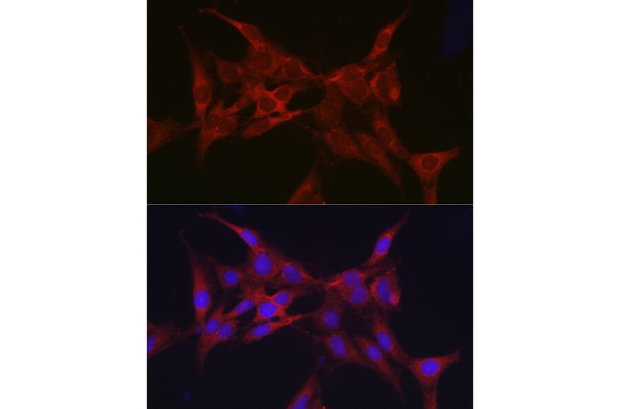 Immunofluorescence - Anti-Parkin Antibody (A80577) - Antibodies.com