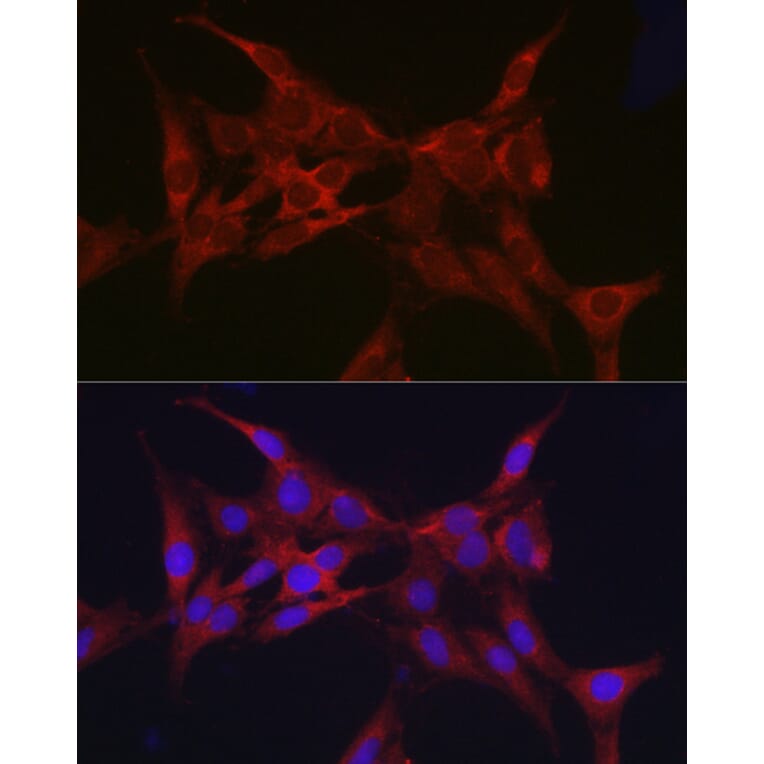 Immunofluorescence - Anti-Parkin Antibody (A80577) - Antibodies.com