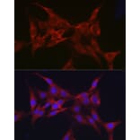 Immunofluorescence - Anti-Parkin Antibody (A80577) - Antibodies.com