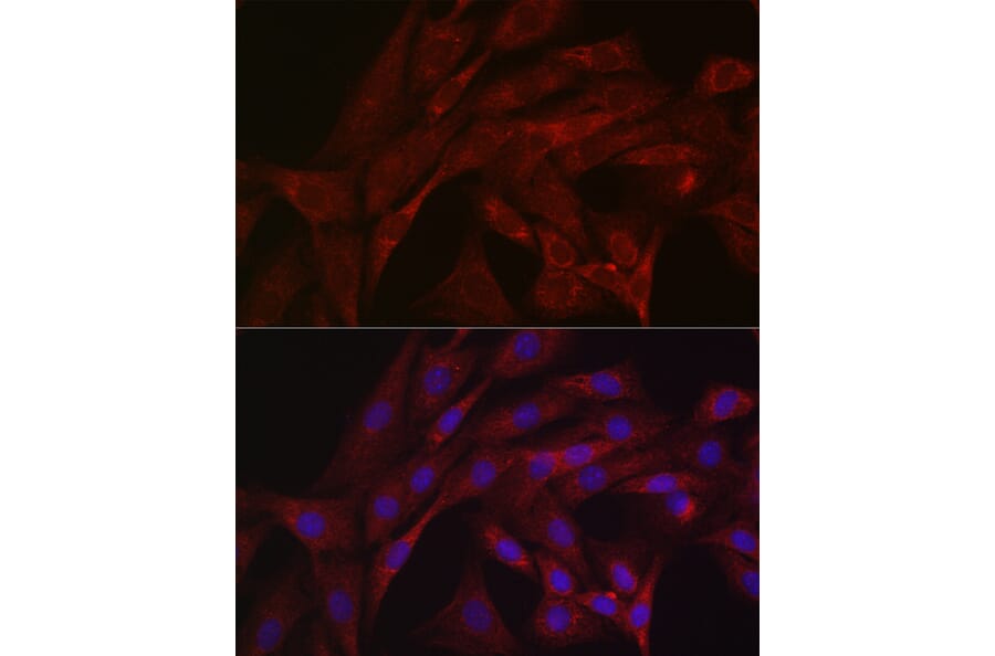Immunofluorescence - Anti-Parkin Antibody (A80577) - Antibodies.com