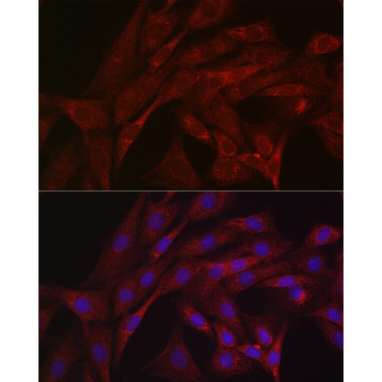 Immunofluorescence - Anti-Parkin Antibody (A80577) - Antibodies.com