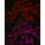 Immunofluorescence - Anti-Parkin Antibody (A80577) - Antibodies.com