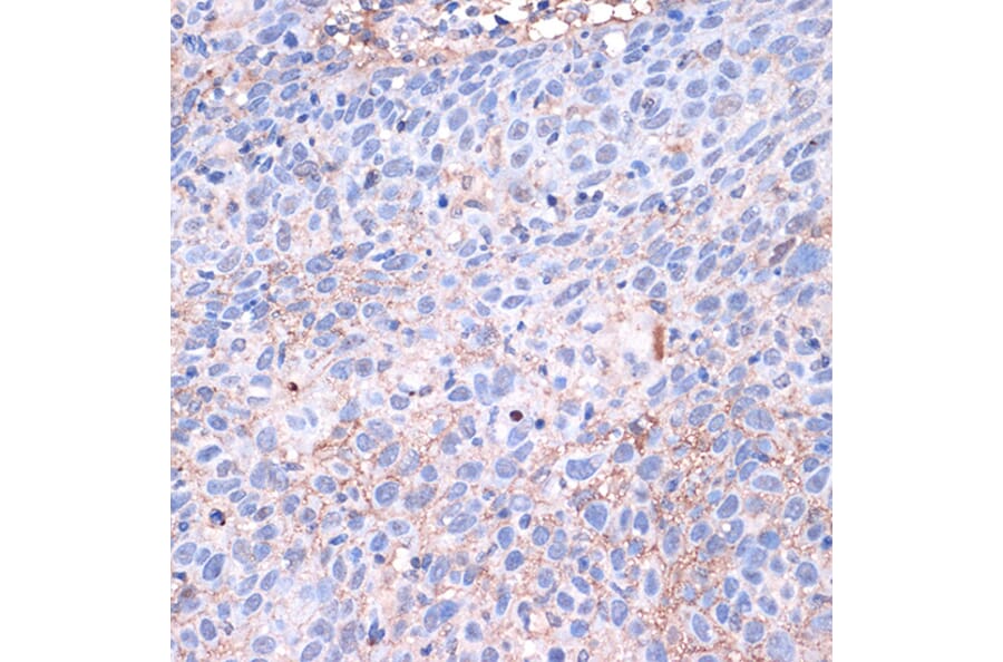 Immunohistochemistry - Anti-PD-L1 Antibody (A80578) - Antibodies.com