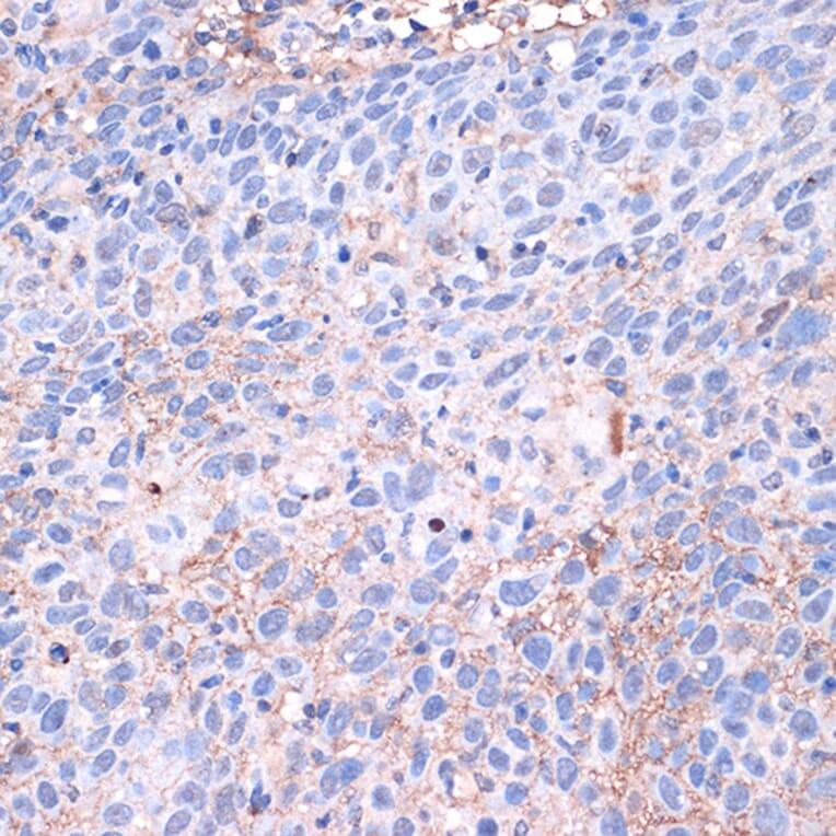 Immunohistochemistry - Anti-PD-L1 Antibody (A80578) - Antibodies.com