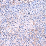 Immunohistochemistry - Anti-PD-L1 Antibody (A80578) - Antibodies.com