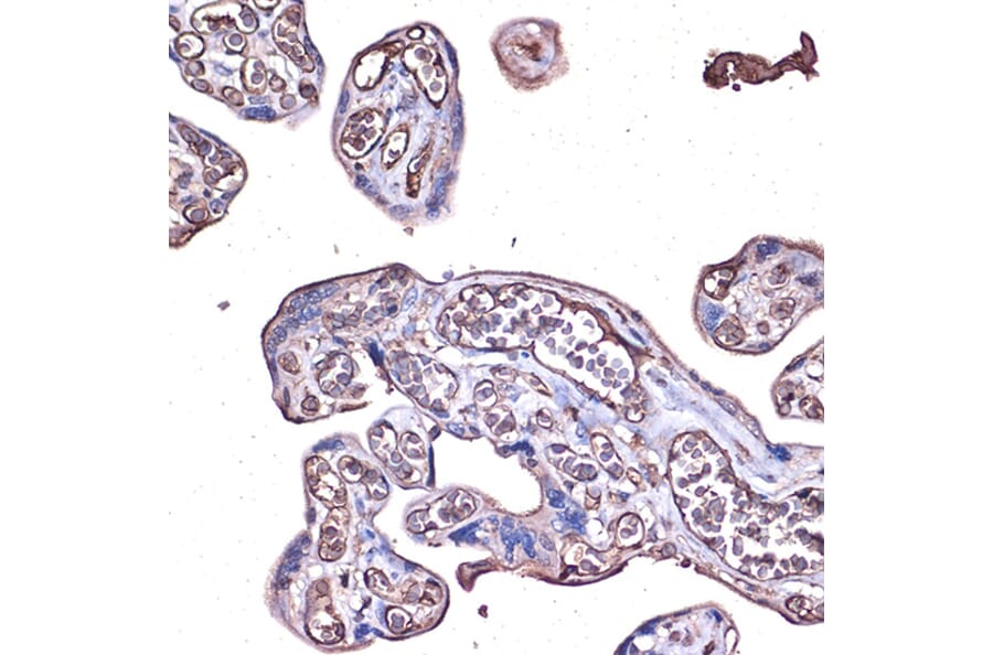 Immunohistochemistry - Anti-PD-L1 Antibody (A80578) - Antibodies.com
