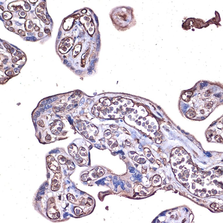 Immunohistochemistry - Anti-PD-L1 Antibody (A80578) - Antibodies.com