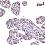 Immunohistochemistry - Anti-PD-L1 Antibody (A80578) - Antibodies.com