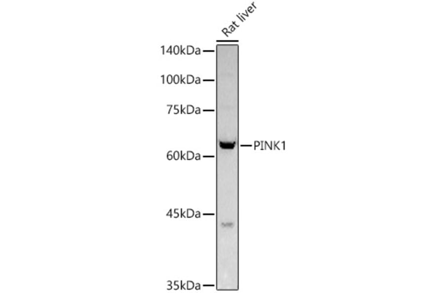 Western Blot - Anti-PINK1 Antibody (A80580) - Antibodies.com