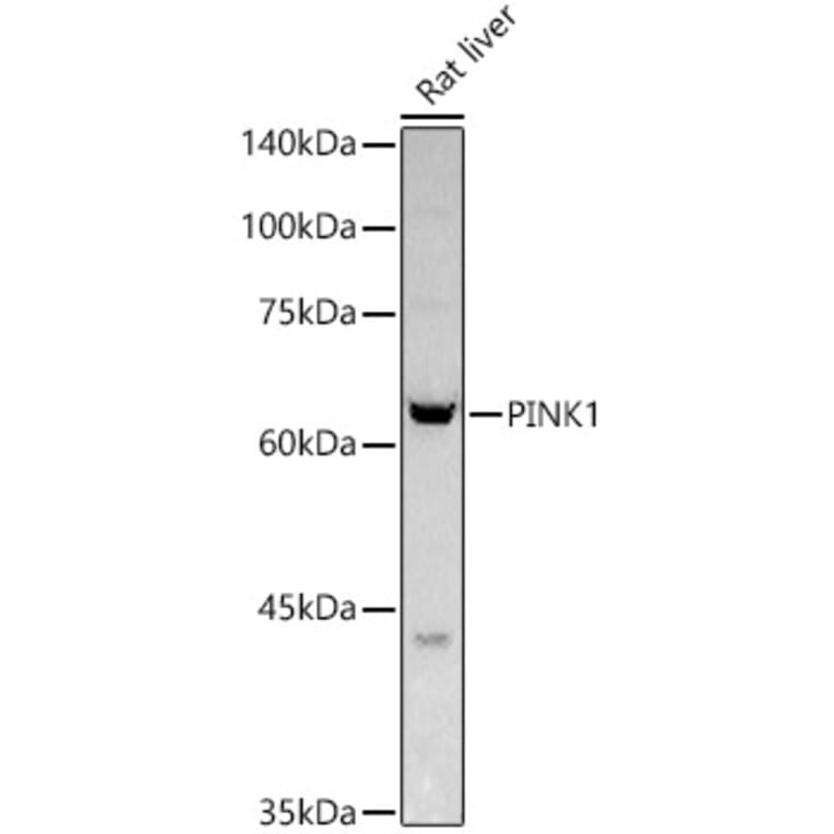 Western Blot - Anti-PINK1 Antibody (A80580) - Antibodies.com