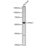 Western Blot - Anti-PINK1 Antibody (A80580) - Antibodies.com