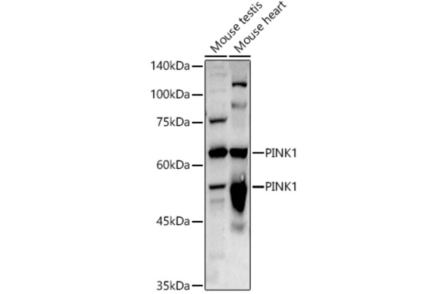 Western Blot - Anti-PINK1 Antibody (A80580) - Antibodies.com