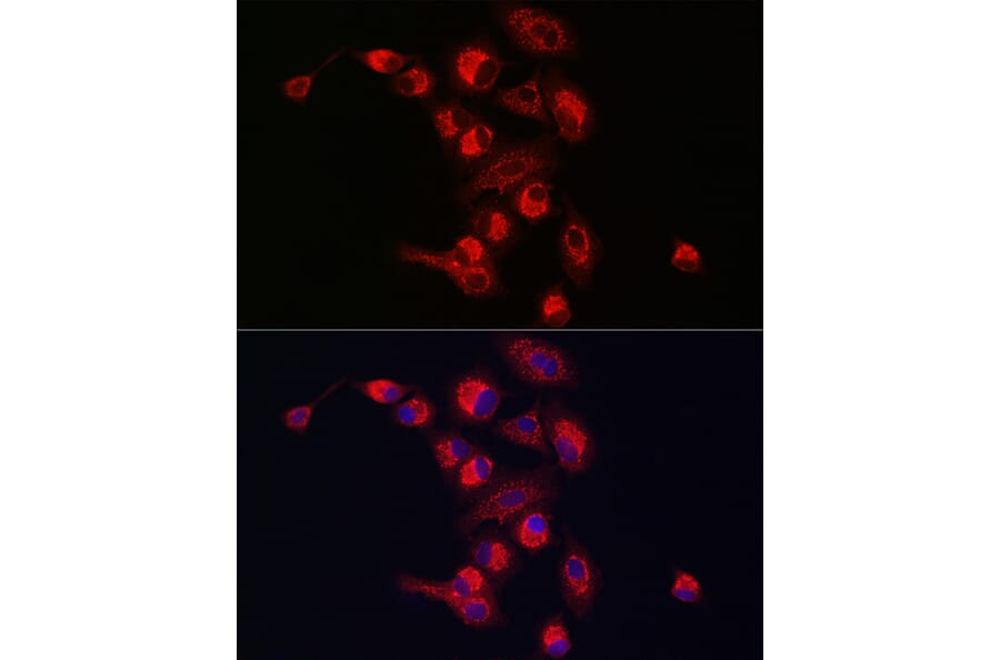 Immunofluorescence - Anti-PINK1 Antibody (A80580) - Antibodies.com