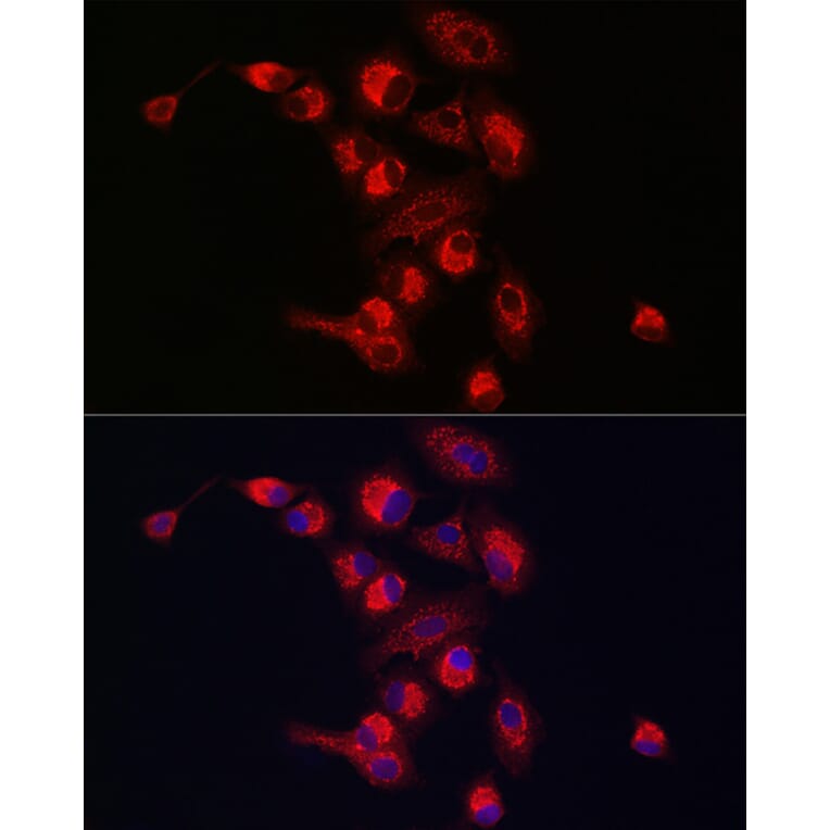 Immunofluorescence - Anti-PINK1 Antibody (A80580) - Antibodies.com