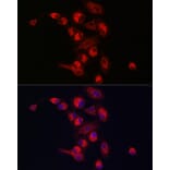 Immunofluorescence - Anti-PINK1 Antibody (A80580) - Antibodies.com