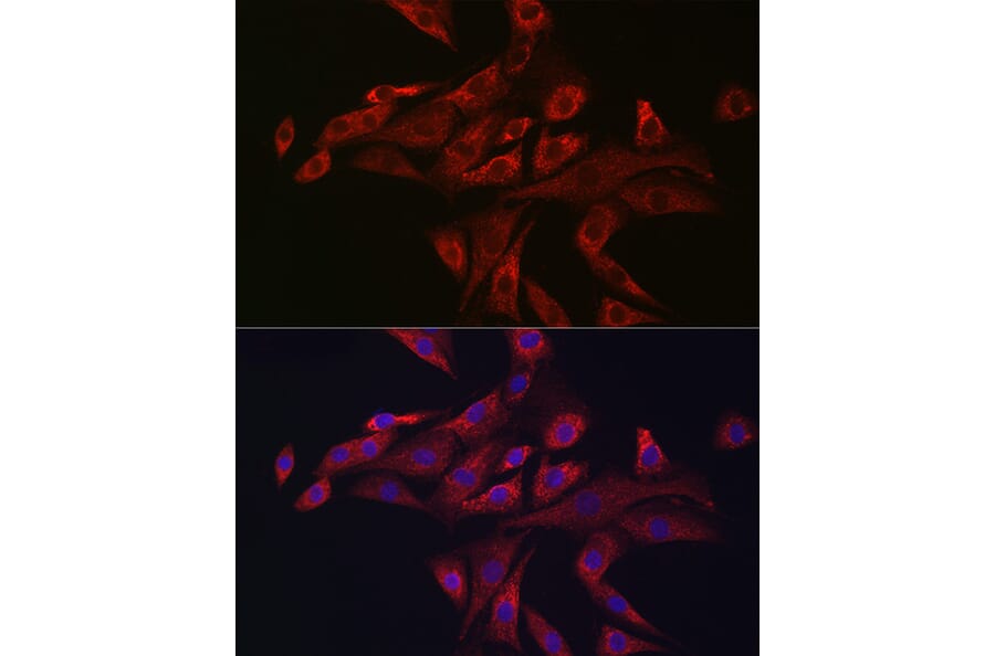 Immunofluorescence - Anti-PINK1 Antibody (A80580) - Antibodies.com