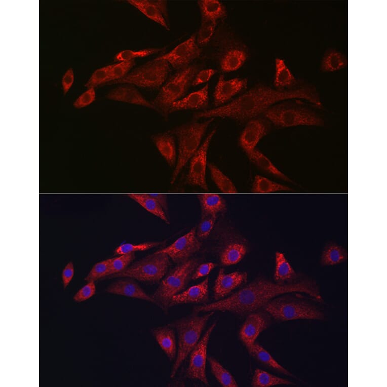 Immunofluorescence - Anti-PINK1 Antibody (A80580) - Antibodies.com