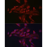 Immunofluorescence - Anti-PINK1 Antibody (A80580) - Antibodies.com