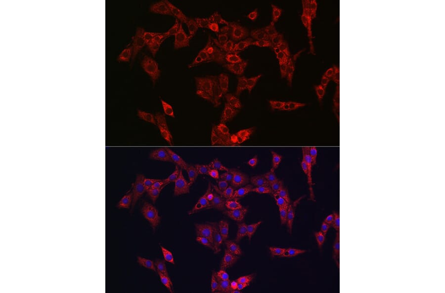 Immunofluorescence - Anti-PINK1 Antibody (A80580) - Antibodies.com