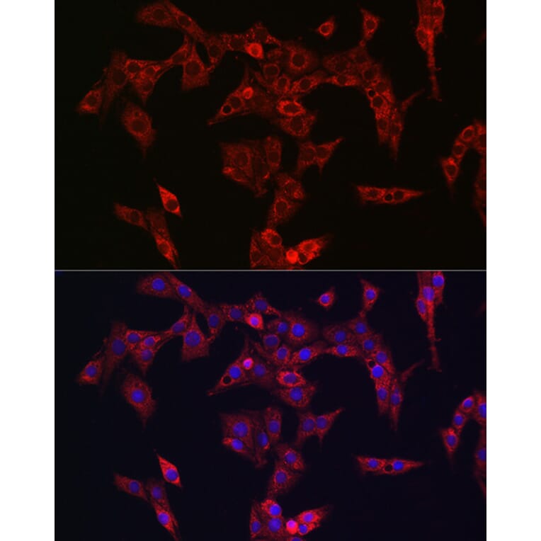 Immunofluorescence - Anti-PINK1 Antibody (A80580) - Antibodies.com