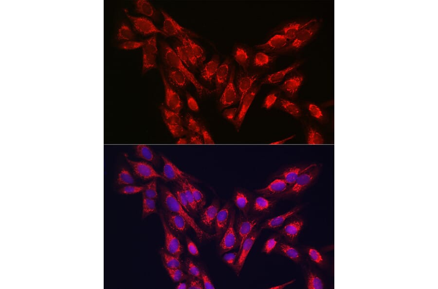 Immunofluorescence - Anti-PINK1 Antibody (A80580) - Antibodies.com