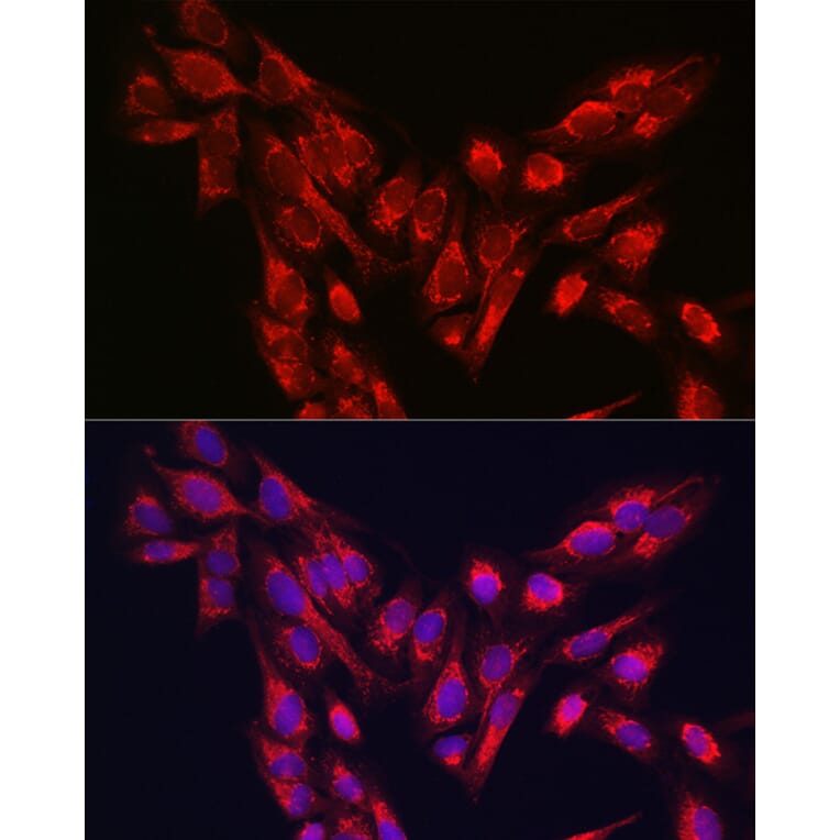Immunofluorescence - Anti-PINK1 Antibody (A80580) - Antibodies.com