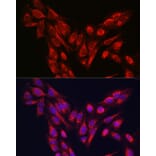 Immunofluorescence - Anti-PINK1 Antibody (A80580) - Antibodies.com