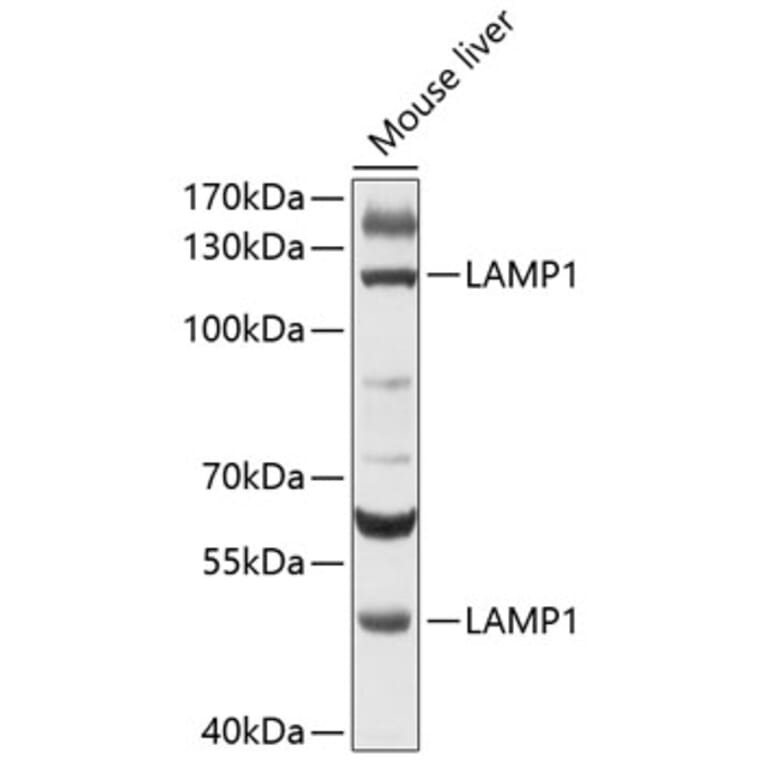 Western Blot - Anti-LAMP1 Antibody (A80581) - Antibodies.com