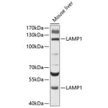 Western Blot - Anti-LAMP1 Antibody (A80581) - Antibodies.com